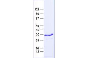 Validation with Western Blot