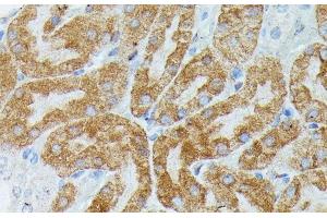 Immunohistochemistry of paraffin-embedded Mouse kidney using MEF2C Polyclonal Antibody at dilution of 1:100 (40x lens). (MEF2C antibody)