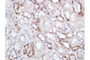 Formalin-fixed and paraffin embedded human kidney labeled with Rabbit Anti-NNT Polyclonal Antibody, Unconjugated  at 1:200 followed by conjugation to the secondary antibody and DAB staining (NNT antibody  (AA 981-1086))
