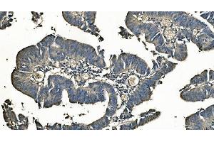IHC analysis of Carbonic Anhydrase I/CA1 using anti-Carbonic Anhydrase I/CA1 antibody (ABIN7602621).