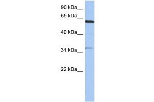 WB Suggested Anti-CDKL2 Antibody Titration: 0. (CDKL2 antibody  (N-Term))