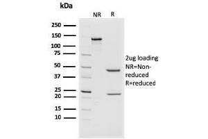 SDS-PAGE Analysis Purified CD44v4/5 Mouse Monoclonal Antibody (3D2).