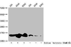 Western Blot Detected samples: 293 whole cell lysate, A549 whole cell lysate, K562 whole cell lysate, Untreated (-) or treated (+) with 30 mM sodium butyrate for 4h All lanes: HIST1H2BC antibody at 1:100 Secondary Goat polyclonal to rabbit IgG at 1/50000 dilution Predicted band size: 14 kDa Observed band size: 14 kDa (Histone H2B antibody  (acLys20))
