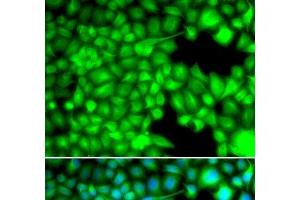 Immunofluorescence analysis of U2OS cells using FABP3 Polyclonal Antibody (FABP3 antibody)