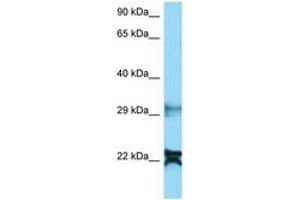 Image no. 1 for anti-NADH Dehydrogenase (Ubiquinone) 1 alpha Subcomplex, 8, 19kDa (NDUFA8) (AA 25-74) antibody (ABIN6748389) (NDUFA8 antibody  (AA 25-74))