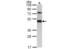 WB Image Sample (30 ug of whole cell lysate) A: H1299 10% SDS PAGE antibody diluted at 1:1000 (TRAM1 antibody  (C-Term))