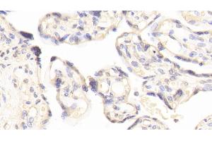 Detection of FN3K in Human Placenta Tissue using Polyclonal Antibody to Fructosamine-3-Kinase (FN3K) (FN3K antibody  (AA 1-309))