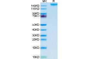 SEZ6 Protein (AA 20-922) (His tag)