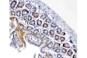 IHC analysis of FH using anti-FH antibody . (FH antibody)