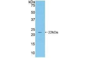 Detection of Recombinant CTLA4, Human using Polyclonal Antibody to Cytotoxic T-Lymphocyte Associated Antigen 4 (CTLA4)