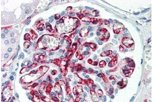 Human Kidney (formalin-fixed, paraffin-embedded) stained with PECAM1 antibody ABIN337092 at 5 ug/ml followed by biotinylated anti-mouse IgG secondary antibody ABIN481714, alkaline phosphatase-streptavidin and chromogen. (CD31 antibody)