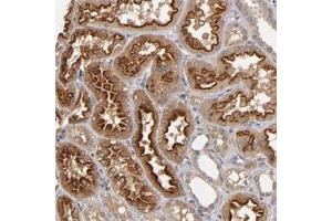 Immunohistochemical staining of human kidney with ASB8 polyclonal antibody  show strong cytoplasmic positivity in cells in tubules.