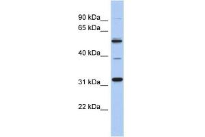 WB Suggested Anti-MGC51025 Antibody Titration: 0.
