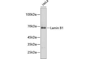 Western blot analysis of extracts of HeLa cells, using Lamin B1 antibody (ABIN1513160, ABIN3023296 and ABIN3023297). (Lamin B1 antibody)
