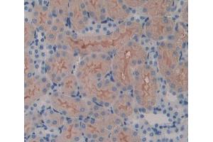 IHC-P analysis of kidney tissue, with DAB staining.