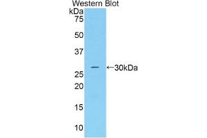 Western blot analysis of the recombinant protein. (Adipsin antibody  (AA 1-263))