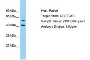 Image no. 1 for anti-DEP Domain Containing 1B (DEPDC1B) (AA 87-136) antibody (ABIN6750177) (DEPDC1B antibody  (AA 87-136))