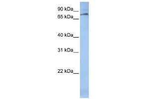 WB Suggested Anti-ALOX12 Antibody Titration: 0. (ALOX12 antibody  (C-Term))