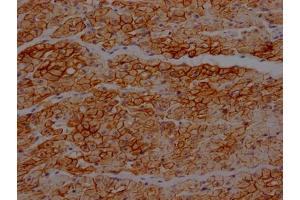 IHC image of ABIN7127460 diluted at 1:100 and staining in paraffin-embedded human heart tissue performed on a Leica BondTM system. (Recombinant Dystrophin antibody)