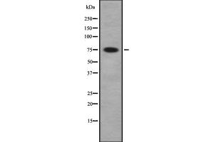 Western blot analysis of PAK5/6 using COLO whole cell lysates (PAK7 antibody  (C-Term))