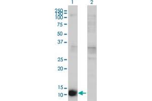 Western Blot analysis of CSTB expression in transfected 293T cell line by CSTB monoclonal antibody (M02), clone M2-F1. (CSTB antibody  (AA 1-98))