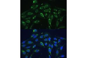 Immunofluorescence analysis of U-2 OS cells using COX6 Polyclonal Antibody (ABIN6132108, ABIN6138915, ABIN6138916 and ABIN6220368) at dilution of 1:100 (40x lens). (COX6A1 antibody  (AA 25-109))