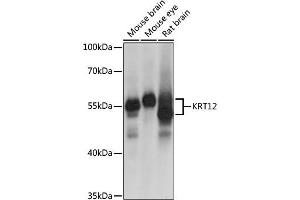 Western blot analysis of extracts of various cell lines, using KRT12 antibody (ABIN6134130) at 1:1000 dilution. (KRT12 antibody  (AA 295-494))