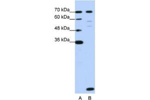 WB Suggested Anti-LSM2 Antibody Titration:  1. (LSM2 antibody  (Middle Region))