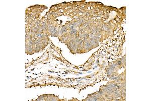 Immunohistochemistry of paraffin-embedded mouse kidney using DNA Ligase III/LIG3 Rabbit pAb (ABIN6130288, ABIN6143207, ABIN6143208 and ABIN6217532) at dilution of 1:50 (40x lens). (LIG3 antibody  (AA 730-1009))