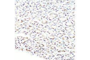 Immunohistochemistry of paraffin-embedded mouse stomach using PRPF8 antibody (ABIN5973594) at dilution of 1/100 (40x lens). (PRPF8 antibody)