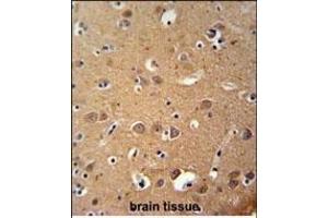 Immunohistochemistry (Paraffin-embedded Sections) (IHC (p)) image for anti-Zinc Finger, DHHC-Type Containing 2 (ZDHHC2) (AA 77-106) antibody (ABIN651781)