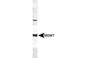Western blot analysis of MGMT in CEM whole cell extract using MGMT monoclonal antibody, clone MT 23.