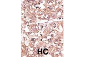Immunohistochemistry (IHC) image for anti-Toll-Like Receptor 7 (TLR7) antibody (ABIN2998417) (TLR7 antibody)