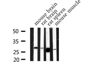 Western blot analysis of MBL2 expression in various lysates (MBL2 antibody  (N-Term))