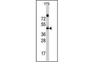 Western blot analysis of CD107a / LAMP1 Antibody (N-term) Cat. (LAMP1 antibody  (N-Term))