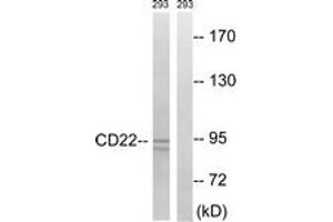 Western blot analysis of extracts from 293 cells, treated with Ca2+ 40nM 30', using BL-CAM (Ab-807) Antibody. (CD22 antibody  (AA 776-825))