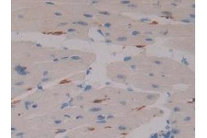 Immunohistochemistry (IHC) image for anti-Coagulation Factor XIII, A1 Polypeptide (F13A1) (AA 372-616) antibody (ABIN7442897)