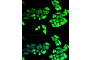 Immunofluorescence analysis of U2OS cells using BEST1 Polyclonal Antibody (Bestrophin 1 antibody)
