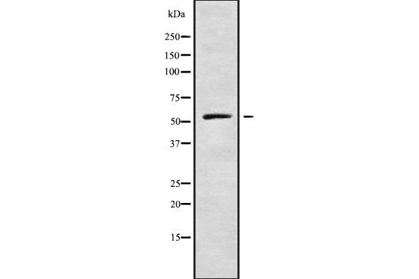 AK8 antibody  (Internal Region)