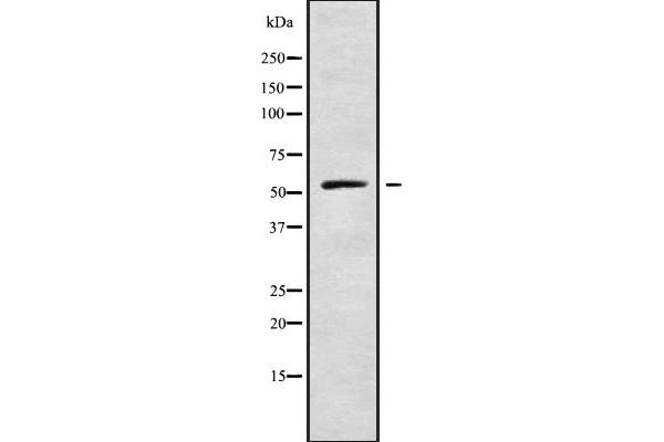 AK8 antibody  (Internal Region)