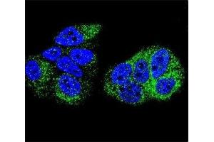 Confocal immunofluorescent analysis of HNF4A antibody with MCF-7 cells followed by Alexa Fluor 488-conjugated goat anti-rabbit lgG (green). (HNF4A antibody  (AA 107-139))