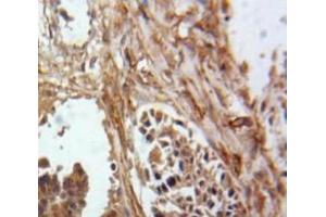 #VALUE! (Inhibin alpha antibody  (AA 25-363))