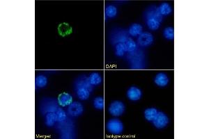 Immunofluorescence staining of mouse splenocytes using anti-MHC I antibody R1-21. (Recombinant MHC, Class I antibody)
