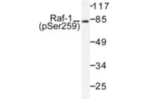 Image no. 1 for anti-V-Raf-1 Murine Leukemia Viral Oncogene Homolog 1 (RAF1) (pSer259) antibody (ABIN318109) (RAF1 antibody  (pSer259))