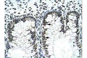 Image no. 3 for anti-GLI Family Zinc Finger 2 (GLI2) (AA 600-649) antibody (ABIN202982) (GLI2 antibody  (AA 600-649))