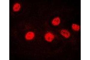 Immunofluorescent analysis of Ikaros staining in U2OS cells. (IKZF1 antibody)