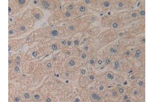 Detection of PK2 in Human Liver Tissue using Polyclonal Antibody to Prokineticin 2 (PK2) (PROK2 antibody  (AA 30-128))