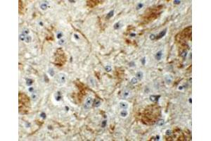 Immunohistochemical staining of mouse brain cells with LCMT2 polyclonal antibody  at 5 ug/mL. (LCMT2 antibody  (N-Term))