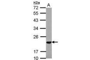 Image no. 2 for anti-S-Phase Kinase-Associated Protein 1 (SKP1) (AA 1-163) antibody (ABIN1500944) (SKP1 antibody  (AA 1-163))