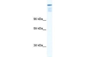 WB Suggested Anti-ZFP106 Antibody Titration: 0. (ZFP106 antibody  (N-Term))
